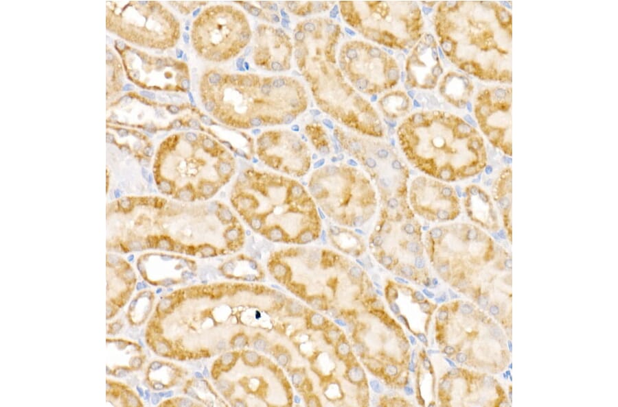 Immunohistochemistry - Anti-GALNT2 Antibody (A15424) - Antibodies.com
