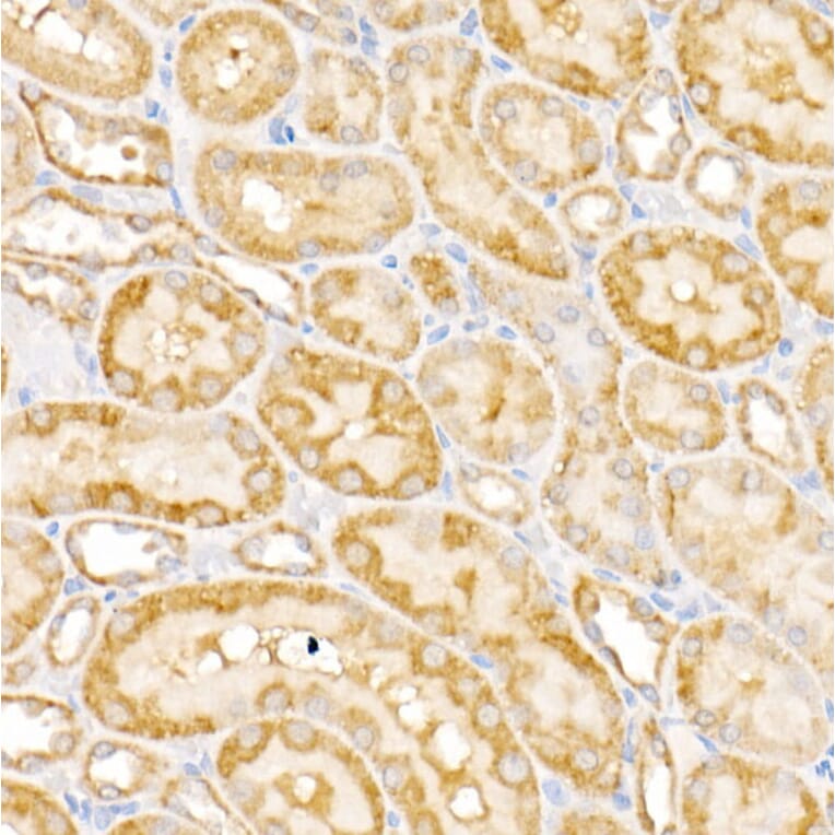 Immunohistochemistry - Anti-GALNT2 Antibody (A15424) - Antibodies.com
