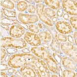 Immunohistochemistry - Anti-GALNT2 Antibody (A15424) - Antibodies.com