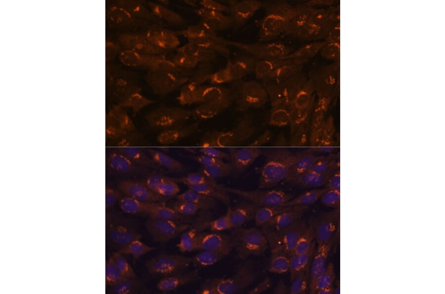 Immunofluorescence - Anti-GALNT2 Antibody (A15424) - Antibodies.com