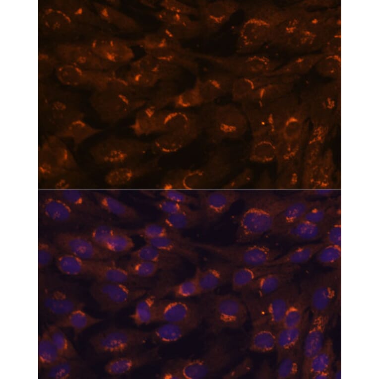 Immunofluorescence - Anti-GALNT2 Antibody (A15424) - Antibodies.com
