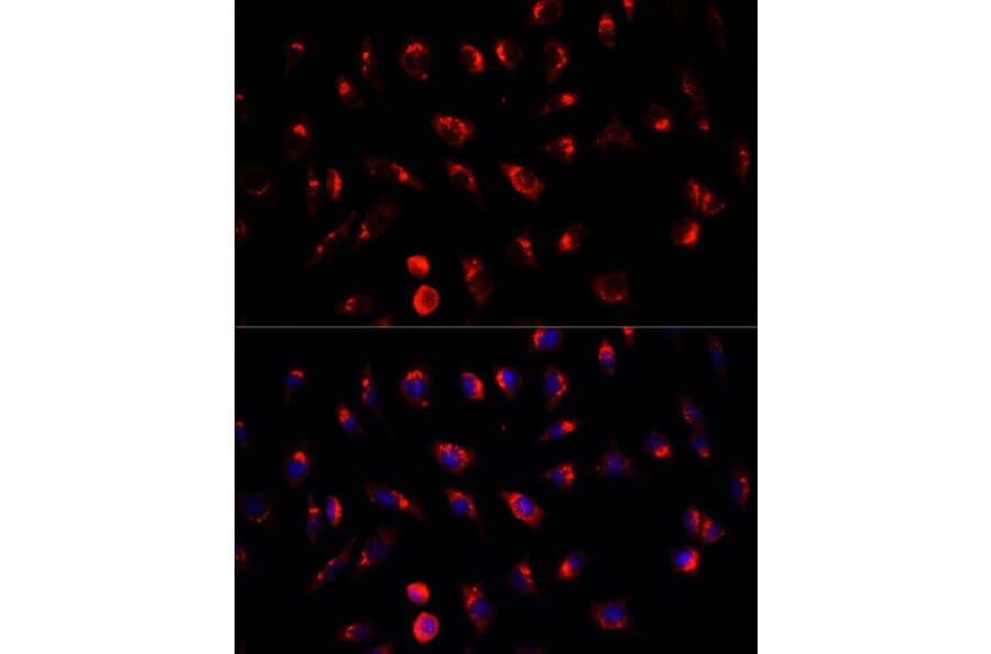 Immunofluorescence - Anti-GALNT2 Antibody (A15424) - Antibodies.com