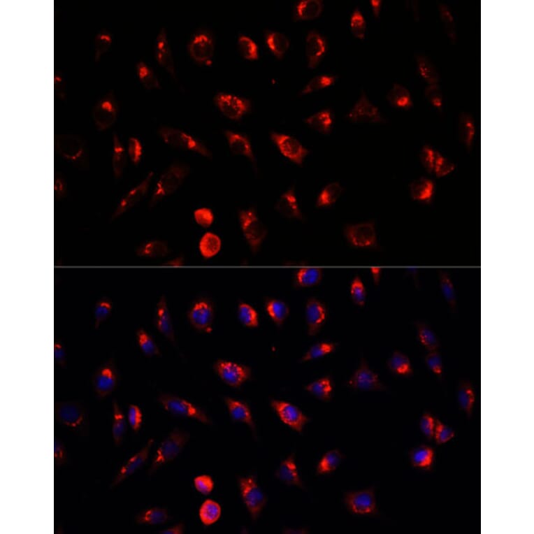 Immunofluorescence - Anti-GALNT2 Antibody (A15424) - Antibodies.com