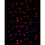 Immunofluorescence - Anti-GALNT2 Antibody (A15424) - Antibodies.com