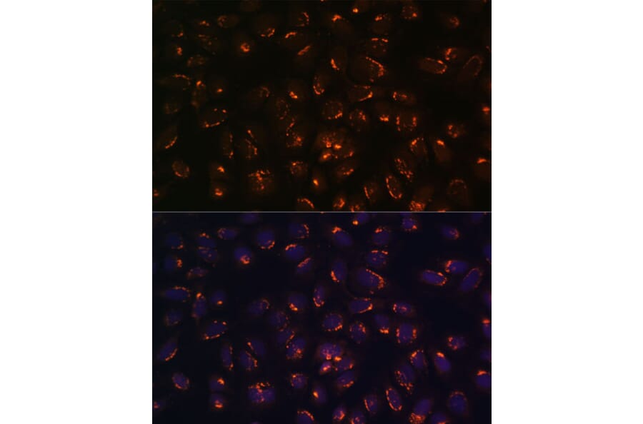Immunofluorescence - Anti-GALNT2 Antibody (A15424) - Antibodies.com