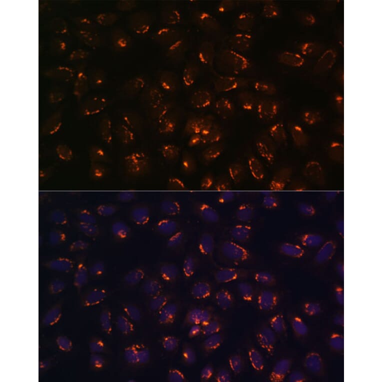 Immunofluorescence - Anti-GALNT2 Antibody (A15424) - Antibodies.com