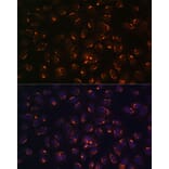 Immunofluorescence - Anti-GALNT2 Antibody (A15424) - Antibodies.com