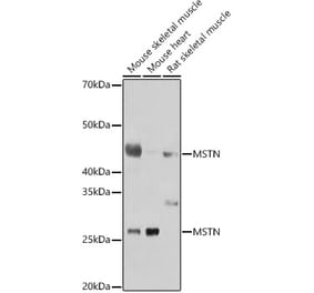 Western Blot - Anti-GDF8 / Myostatin Antibody (A15425) - Antibodies.com