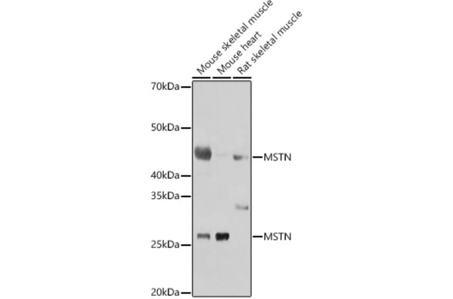 Western Blot - Anti-GDF8/Myostatin Antibody (A15425) - Antibodies.com