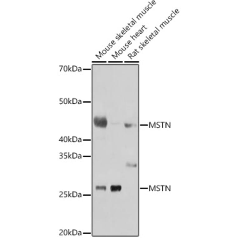 Western Blot - Anti-GDF8/Myostatin Antibody (A15425) - Antibodies.com