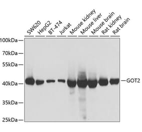Western Blot - Anti-FABP-1 Antibody (A15426) - Antibodies.com