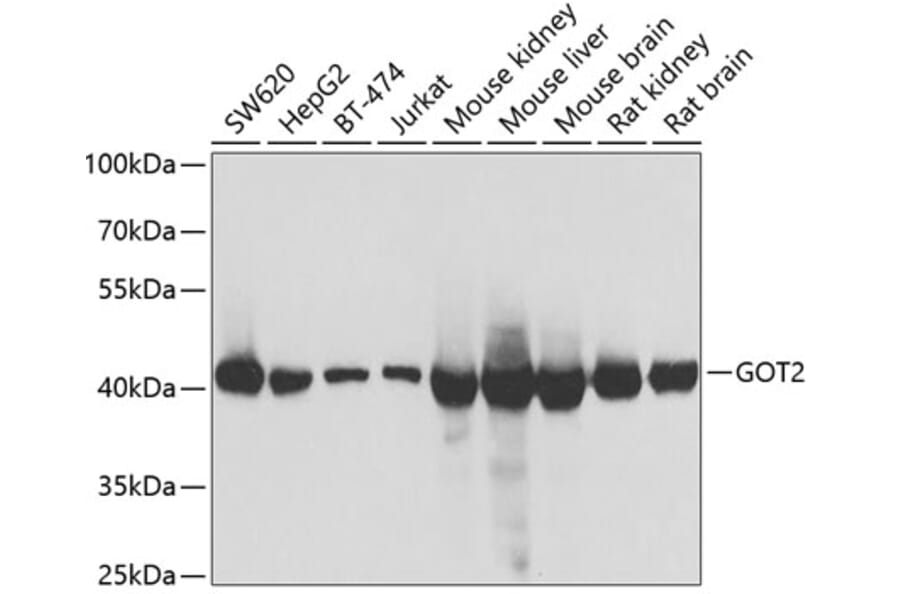 Western Blot - Anti-FABP-1 Antibody (A15426) - Antibodies.com