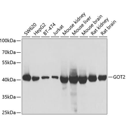 Western Blot - Anti-FABP-1 Antibody (A15426) - Antibodies.com