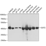 Western Blot - Anti-FABP-1 Antibody (A15426) - Antibodies.com