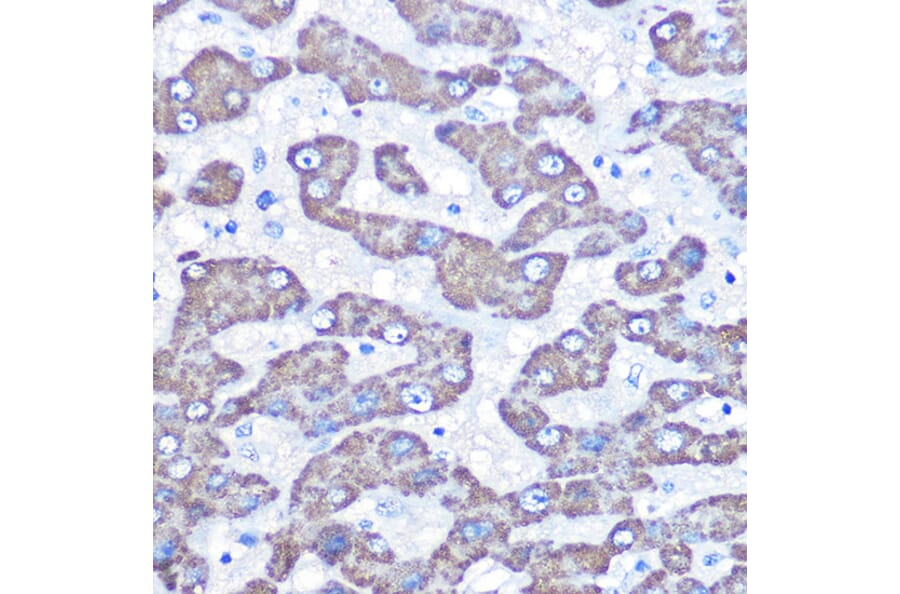 Immunohistochemistry - Anti-FABP-1 Antibody (A15426) - Antibodies.com
