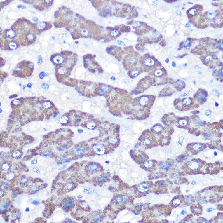 Immunohistochemistry - Anti-FABP-1 Antibody (A15426) - Antibodies.com