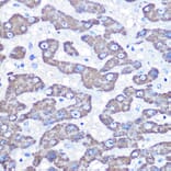 Immunohistochemistry - Anti-FABP-1 Antibody (A15426) - Antibodies.com