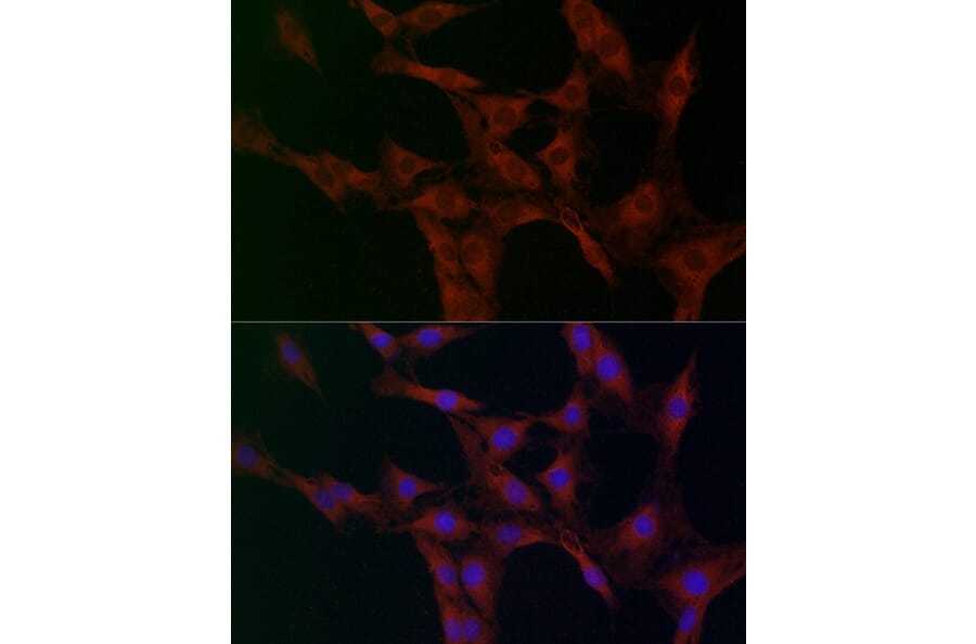 Immunofluorescence - Anti-FABP-1 Antibody (A15426) - Antibodies.com