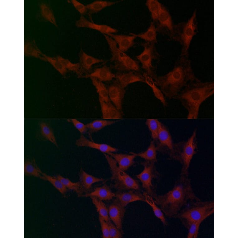 Immunofluorescence - Anti-FABP-1 Antibody (A15426) - Antibodies.com
