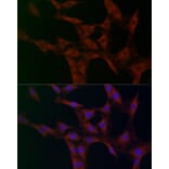 Immunofluorescence - Anti-FABP-1 Antibody (A15426) - Antibodies.com