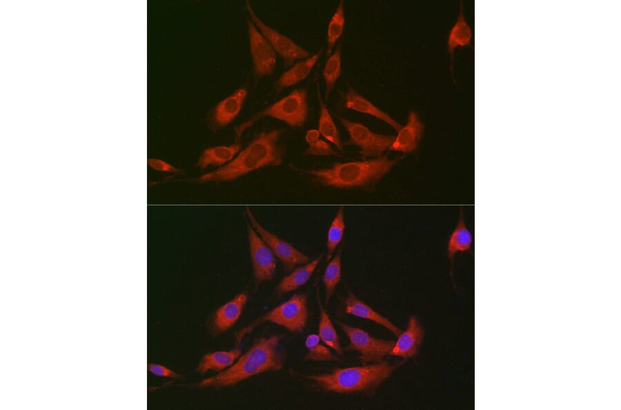 Immunofluorescence - Anti-FABP-1 Antibody (A15426) - Antibodies.com