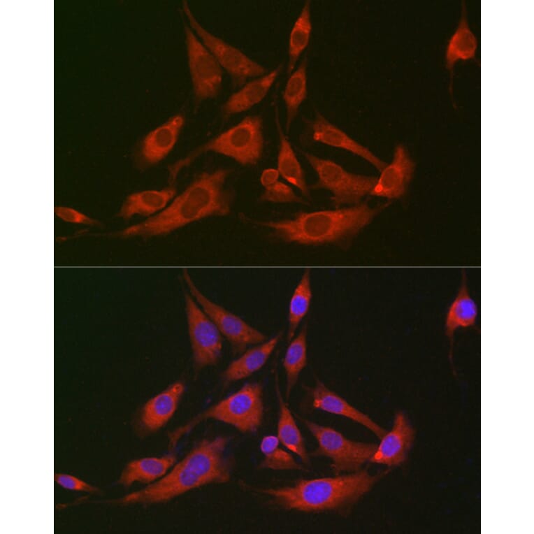 Immunofluorescence - Anti-FABP-1 Antibody (A15426) - Antibodies.com