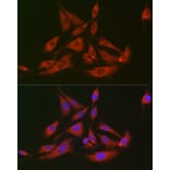 Immunofluorescence - Anti-FABP-1 Antibody (A15426) - Antibodies.com