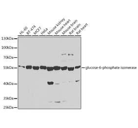 Western Blot - Anti-GPI Antibody (A15427) - Antibodies.com