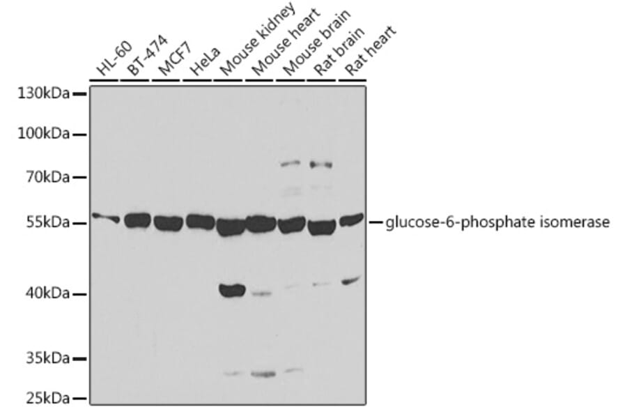 Western Blot - Anti-GPI Antibody (A15427) - Antibodies.com
