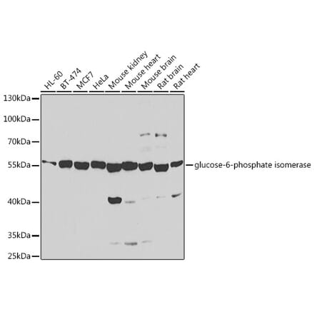 Western Blot - Anti-GPI Antibody (A15427) - Antibodies.com