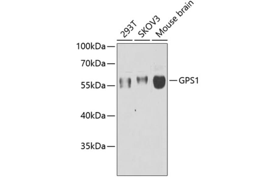 Western Blot - Anti-CSN1 Antibody (A15428) - Antibodies.com