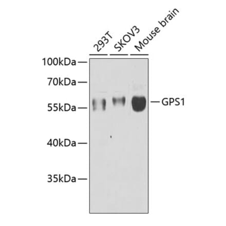 Western Blot - Anti-CSN1 Antibody (A15428) - Antibodies.com