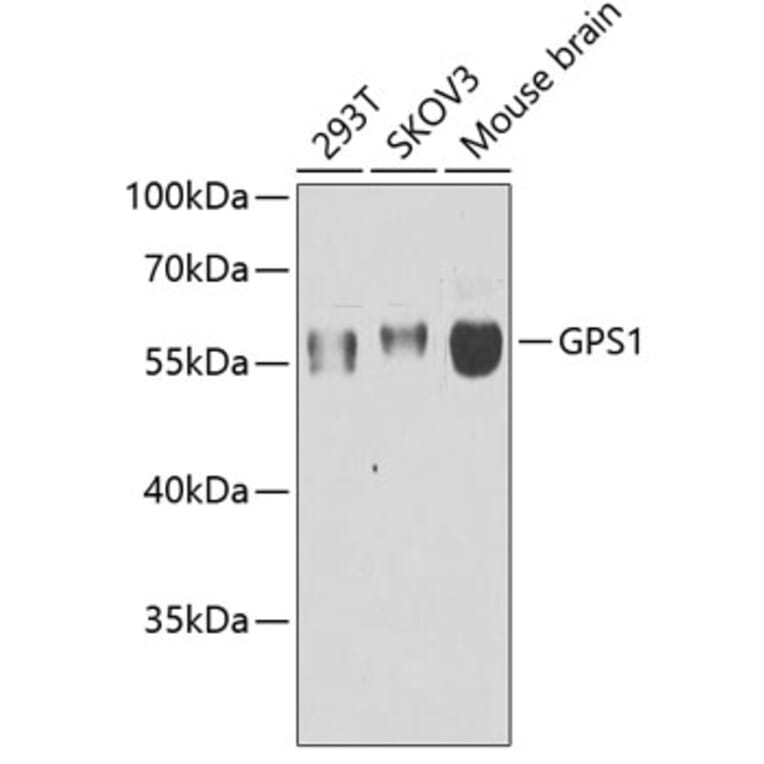 Western Blot - Anti-CSN1 Antibody (A15428) - Antibodies.com