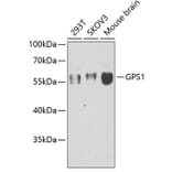 Western Blot - Anti-CSN1 Antibody (A15428) - Antibodies.com