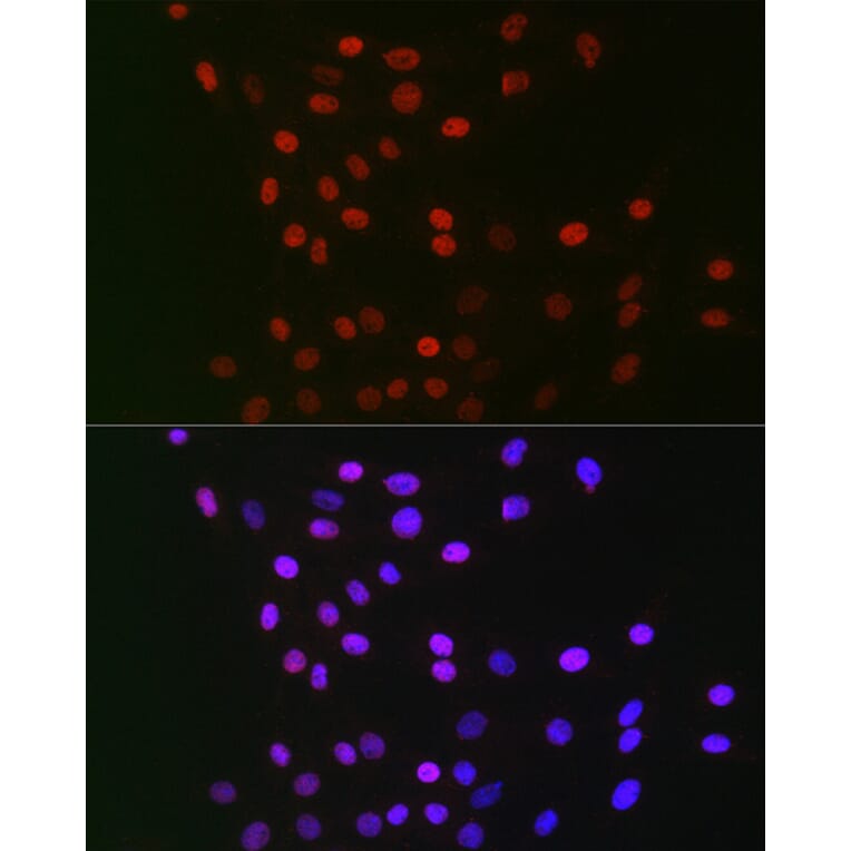 Immunofluorescence - Anti-CSN1 Antibody (A15428) - Antibodies.com