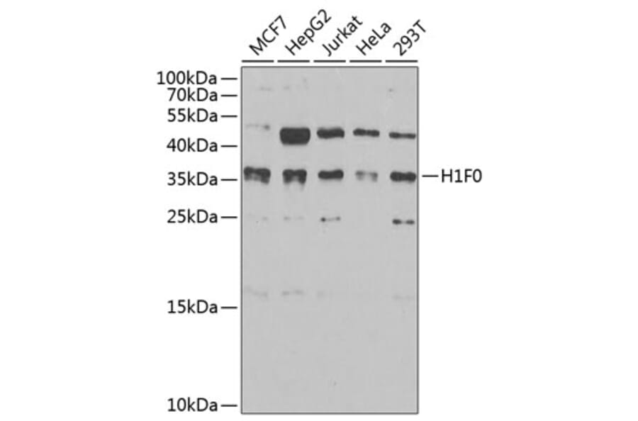Western Blot - Anti-Histone H1.0 Antibody (A15429) - Antibodies.com