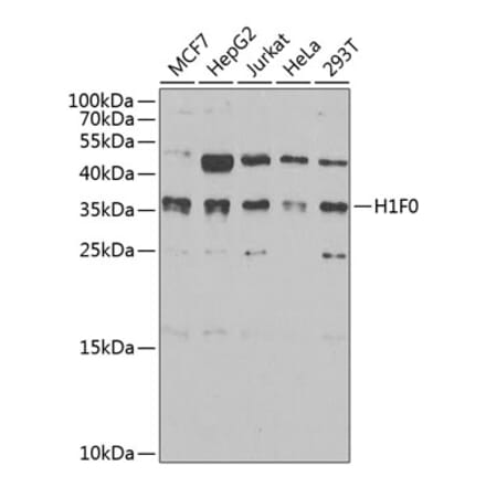 Western Blot - Anti-Histone H1.0 Antibody (A15429) - Antibodies.com