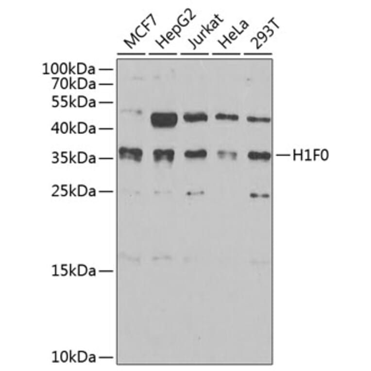 Western Blot - Anti-Histone H1.0 Antibody (A15429) - Antibodies.com