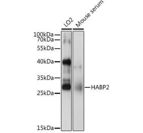 Western Blot - Anti-HABP2 Antibody (A15430) - Antibodies.com