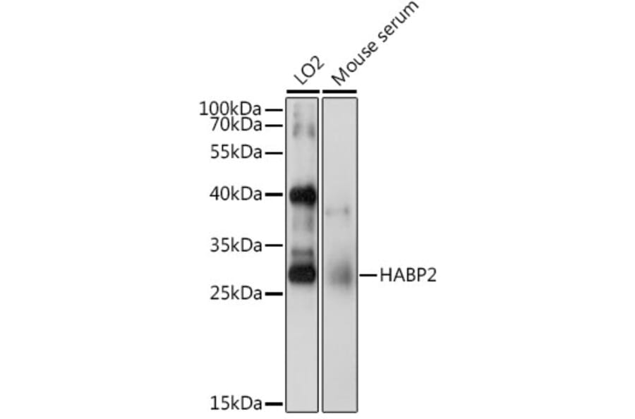 Western Blot - Anti-HABP2 Antibody (A15430) - Antibodies.com