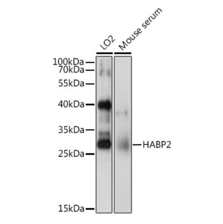 Western Blot - Anti-HABP2 Antibody (A15430) - Antibodies.com