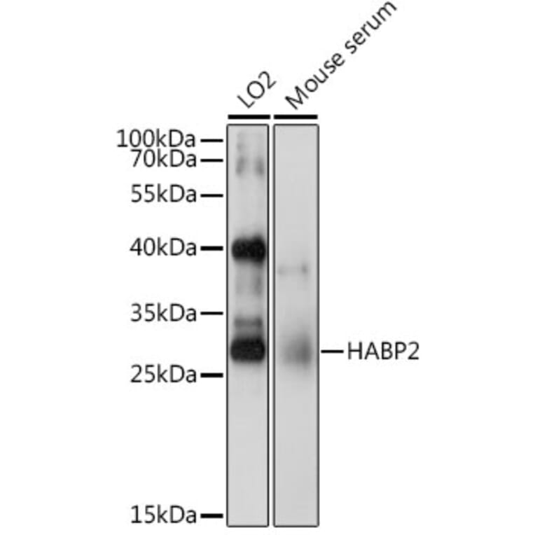 Western Blot - Anti-HABP2 Antibody (A15430) - Antibodies.com