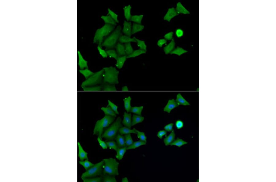 Immunofluorescence - Anti-HABP2 Antibody (A15430) - Antibodies.com