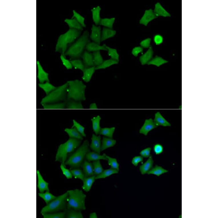 Immunofluorescence - Anti-HABP2 Antibody (A15430) - Antibodies.com