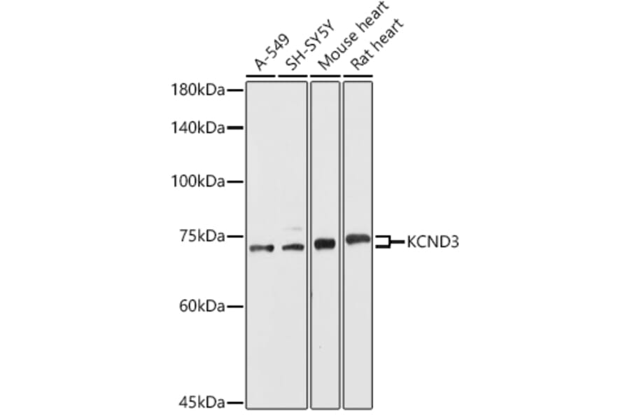 Western Blot - Anti-Kv4.3/KCND3 Antibody (A15431) - Antibodies.com