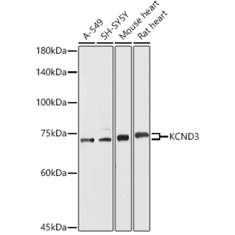 Western Blot - Anti-Kv4.3/KCND3 Antibody (A15431) - Antibodies.com