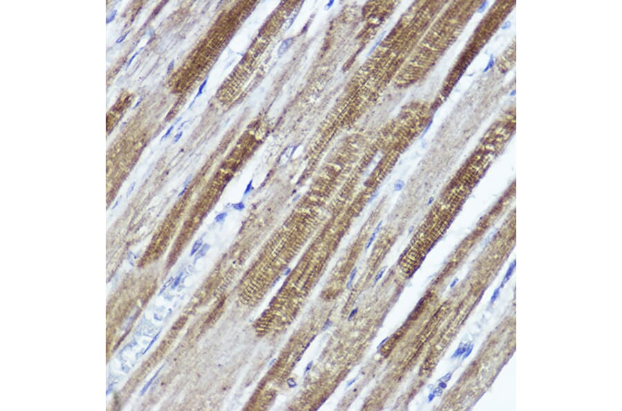Immunohistochemistry - Anti-Kv4.3/KCND3 Antibody (A15431) - Antibodies.com