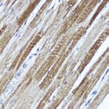 Immunohistochemistry - Anti-Kv4.3/KCND3 Antibody (A15431) - Antibodies.com