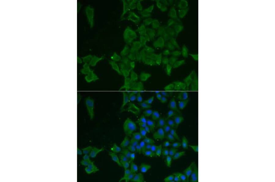 Immunofluorescence - Anti-LGALS3BP Antibody (A15432) - Antibodies.com