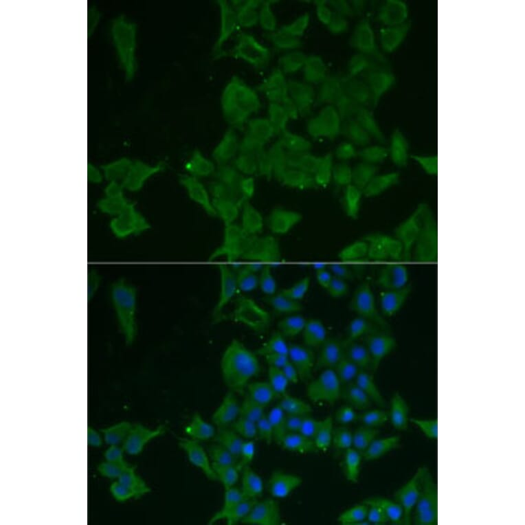 Immunofluorescence - Anti-LGALS3BP Antibody (A15432) - Antibodies.com